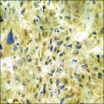 抗-磷酸化-CDK5 (pTyr15) 兔抗 affinity isolated antibody