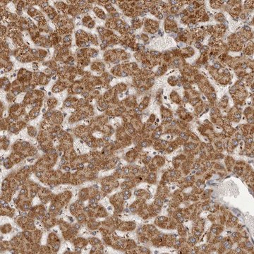 Anti-SEMA3A antibody produced in rabbit Prestige Antibodies&#174; Powered by Atlas Antibodies, affinity isolated antibody, buffered aqueous glycerol solution