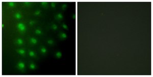 Anti-AKAP8 antibody produced in rabbit affinity isolated antibody