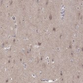 Anti-ABL2 antibody produced in rabbit Prestige Antibodies® Powered by Atlas Antibodies, affinity isolated antibody