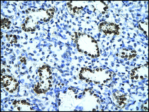 Anti-ENO1 (AB1) antibody produced in rabbit IgG fraction of antiserum