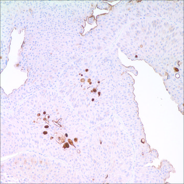 Uroplakin III (AU-1) Mouse Monoclonal Antibody