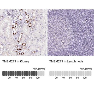 Anti-TMEM213 antibody produced in rabbit Prestige Antibodies&#174; Powered by Atlas Antibodies, affinity isolated antibody, buffered aqueous glycerol solution