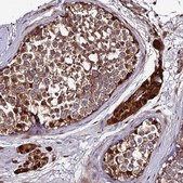 Anti-DDX19A antibody produced in rabbit Prestige Antibodies® Powered by Atlas Antibodies, affinity isolated antibody, buffered aqueous glycerol solution