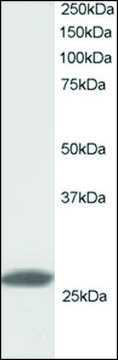 Anti-ANP32B (C-terminal) antibody produced in goat affinity isolated antibody, buffered aqueous solution