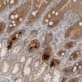 Anti-HTRA2 antibody produced in rabbit Prestige Antibodies® Powered by Atlas Antibodies, affinity isolated antibody, buffered aqueous glycerol solution