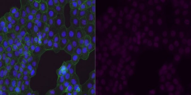 Anti-GLUT-1 Antibody, CT, Alexa Fluor&#8482; 647 Conjugate from rabbit, ALEXA FLUOR&#8482; 647