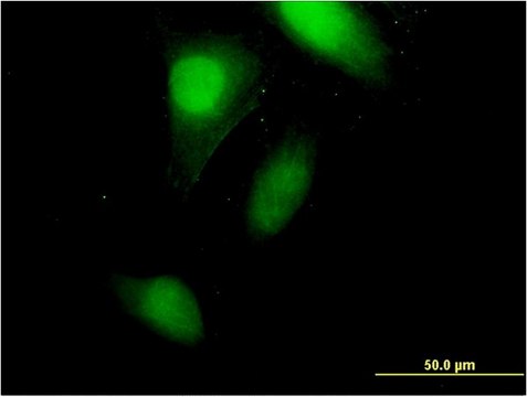 Monoclonal Anti-CRABP2 antibody produced in mouse clone 4F2, purified immunoglobulin, buffered aqueous solution