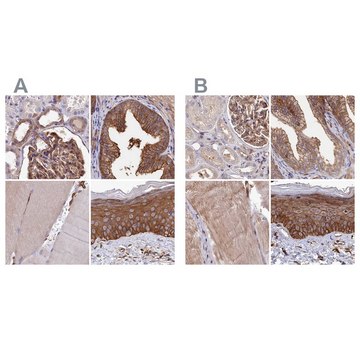 Anti-TNKS1BP1 antibody produced in rabbit Prestige Antibodies&#174; Powered by Atlas Antibodies, affinity isolated antibody, buffered aqueous glycerol solution