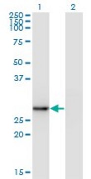 Monoclonal Anti-EXOSC5, (N-terminal) antibody produced in mouse clone 1E11, purified immunoglobulin, buffered aqueous solution