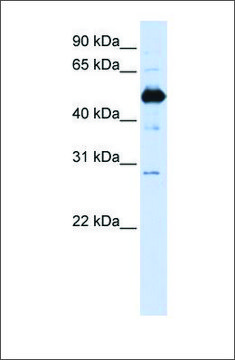 Anti-FAM134B antibody produced in rabbit affinity isolated antibody