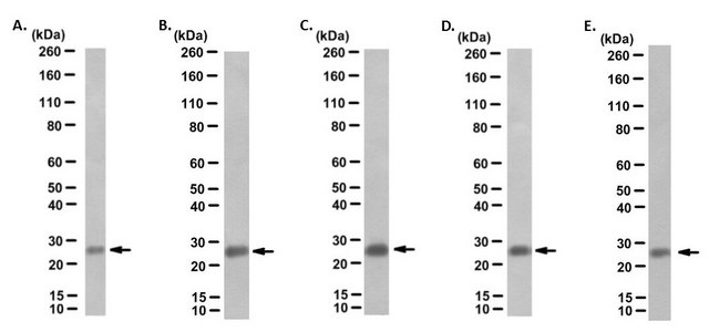 Anti-P53DINP1 Antibody, clone F8 from rat