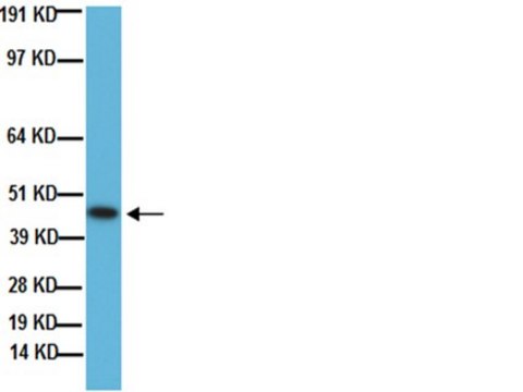 Anti-Growth Associated Protein 43 Antibody, clone 9-1E12 clone 9-1E12, Chemicon&#174;, from mouse