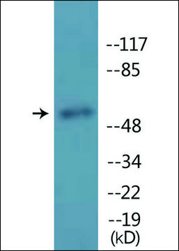 Anti-phospho-MITF (pSer180/73) antibody produced in rabbit affinity isolated antibody