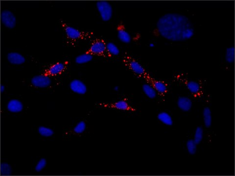 Anti-EDC4 (N-terminal) antibody produced in rabbit ~1.0&#160;mg/mL, affinity isolated antibody