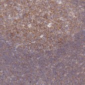 Anti-PPP6C antibody produced in rabbit Prestige Antibodies® Powered by Atlas Antibodies, affinity isolated antibody, buffered aqueous glycerol solution