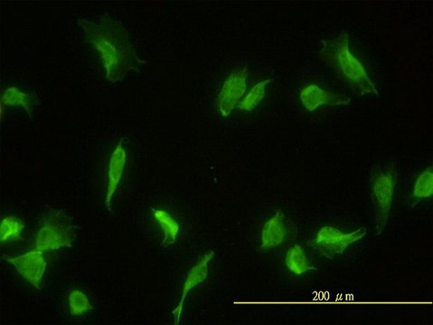 Monoclonal Anti-GLMN antibody produced in mouse clone 1C12, purified immunoglobulin, buffered aqueous solution