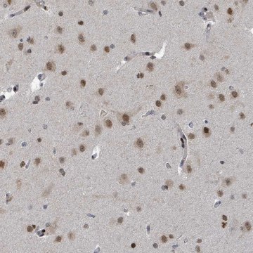 Anti-UCK1 antibody produced in rabbit Prestige Antibodies&#174; Powered by Atlas Antibodies, affinity isolated antibody, buffered aqueous glycerol solution