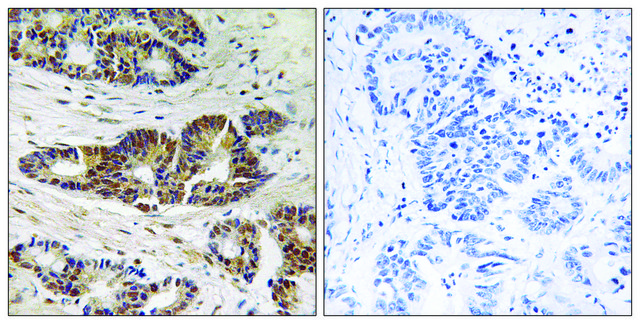 Anti-GRK2 antibody produced in rabbit affinity isolated antibody