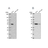 Anti-GSS antibody produced in rabbit Prestige Antibodies® Powered by Atlas Antibodies, affinity isolated antibody