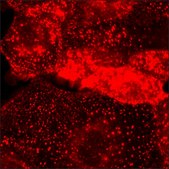 SKOV3 Cells GFP-HER2 RFP-EGFR