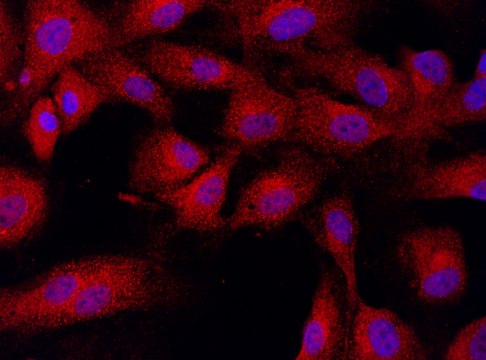 Anti-DPP4 (61-75) antibody produced in rabbit IgG fraction of antiserum, buffered aqueous solution