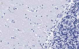 Anti-NOS1 Antibody, clone 1F14 ZooMAb® Rabbit Monoclonal recombinant, expressed in HEK 293 cells
