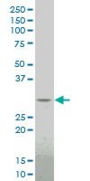 ANTI-DLX1 antibody produced in mouse clone 4B7, purified immunoglobulin, buffered aqueous solution