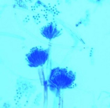 Lactophenol mounting fluid for demonstrating microscopic morphology of fungi