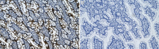 Anti-GSDME/DFN5 Antibody, clone 1H7 ZooMAb&#174; Rabbit Monoclonal recombinant, expressed in HEK 293 cells