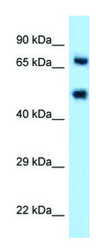 Anti-SELE (N-terminal) antibody produced in rabbit affinity isolated antibody