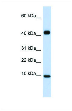 Anti-CCL8 antibody produced in rabbit affinity isolated antibody