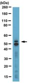 Anti-GLUT-5 Antibody, a.a. 490-502 serum, from rabbit