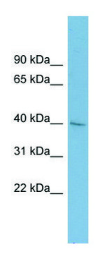 Anti-A4GALT antibody produced in rabbit affinity isolated antibody