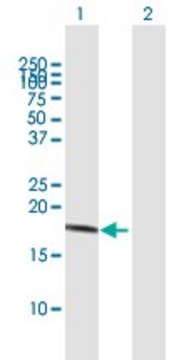 Anti-IL10 antibody produced in mouse purified immunoglobulin, buffered aqueous solution