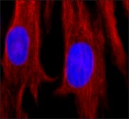 Anti-Vimentin antibody, Mouse monoclonal clone VIM-13.2, purified from hybridoma cell culture