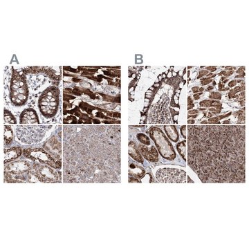 Anti-PDHX antibody produced in rabbit Prestige Antibodies&#174; Powered by Atlas Antibodies, affinity isolated antibody, buffered aqueous glycerol solution