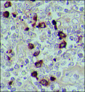 Anti-Human IgA (&#945;-chain specific)&#8722;Peroxidase antibody produced in goat affinity isolated antibody