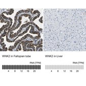 Anti-WNK2 antibody produced in rabbit Prestige Antibodies® Powered by Atlas Antibodies, affinity isolated antibody, buffered aqueous glycerol solution