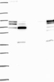 Anti-Grk2 Antibody Produced In Rabbit Prestige Antibodies® Powered by Atlas Antibodies, affinity isolated antibody, buffered aqueous glycerol solution