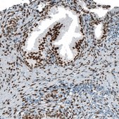 Monoclonal Anti-AR antibody produced in mouse Prestige Antibodies® Powered by Atlas Antibodies, clone CL9255, purified immunoglobulin, buffered aqueous glycerol solution