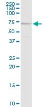 Anti-MEN1 antibody produced in rabbit purified immunoglobulin, buffered aqueous solution