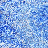 Anti-CD23 antibody produced in rabbit