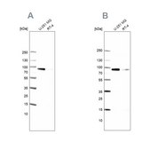 Anti-PLOD1 antibody produced in rabbit Prestige Antibodies® Powered by Atlas Antibodies, affinity isolated antibody, buffered aqueous glycerol solution