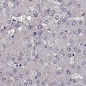 Anti-GRK1 antibody produced in rabbit Prestige Antibodies® Powered by Atlas Antibodies, affinity isolated antibody