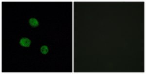 Anti-HNRNP M antibody produced in rabbit affinity isolated antibody