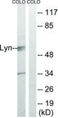 Anti-LYN antibody produced in rabbit affinity isolated antibody