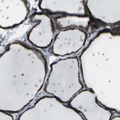 Anti-CMTM4 antibody produced in rabbit Prestige Antibodies® Powered by Atlas Antibodies, affinity isolated antibody, buffered aqueous glycerol solution