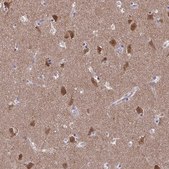 Anti-FBXL16 antibody produced in rabbit Prestige Antibodies® Powered by Atlas Antibodies, affinity isolated antibody, buffered aqueous glycerol solution