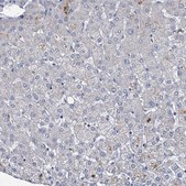 Anti-RTKN2 antibody produced in rabbit Prestige Antibodies® Powered by Atlas Antibodies, affinity isolated antibody, buffered aqueous glycerol solution